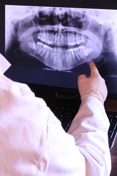 Best Dental Abscess Treatment in Lakewood, CO