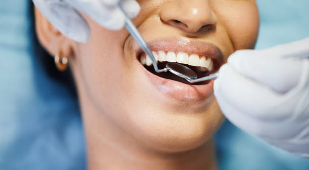 Best Broken or Chipped Tooth Repair in Lakewood, CO