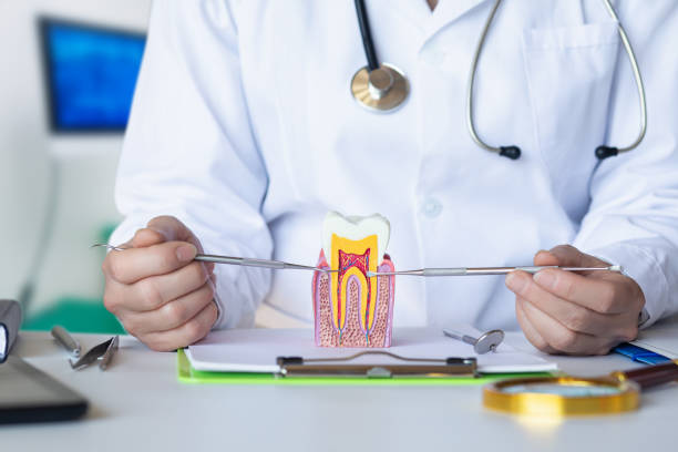 Best Knocked-Out Tooth (Avulsed Tooth) Treatment in Lakewood, CO